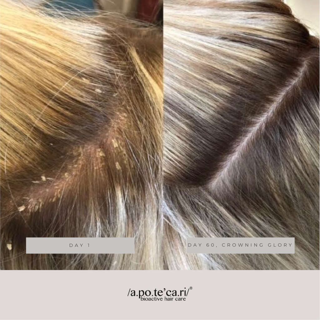 Apotecari Crowning Glory 90 Day Kit