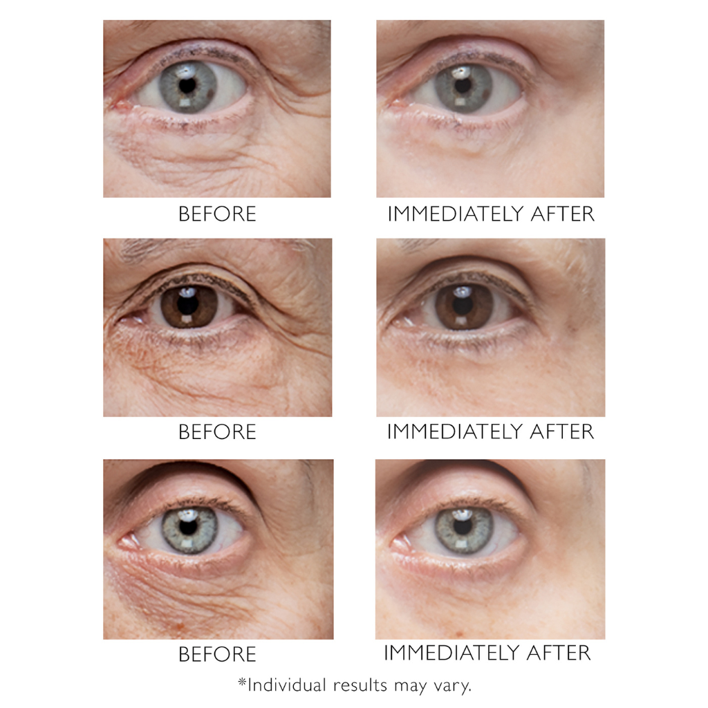 Peter Thomas Roth Instant FirmX Eye 30ml
