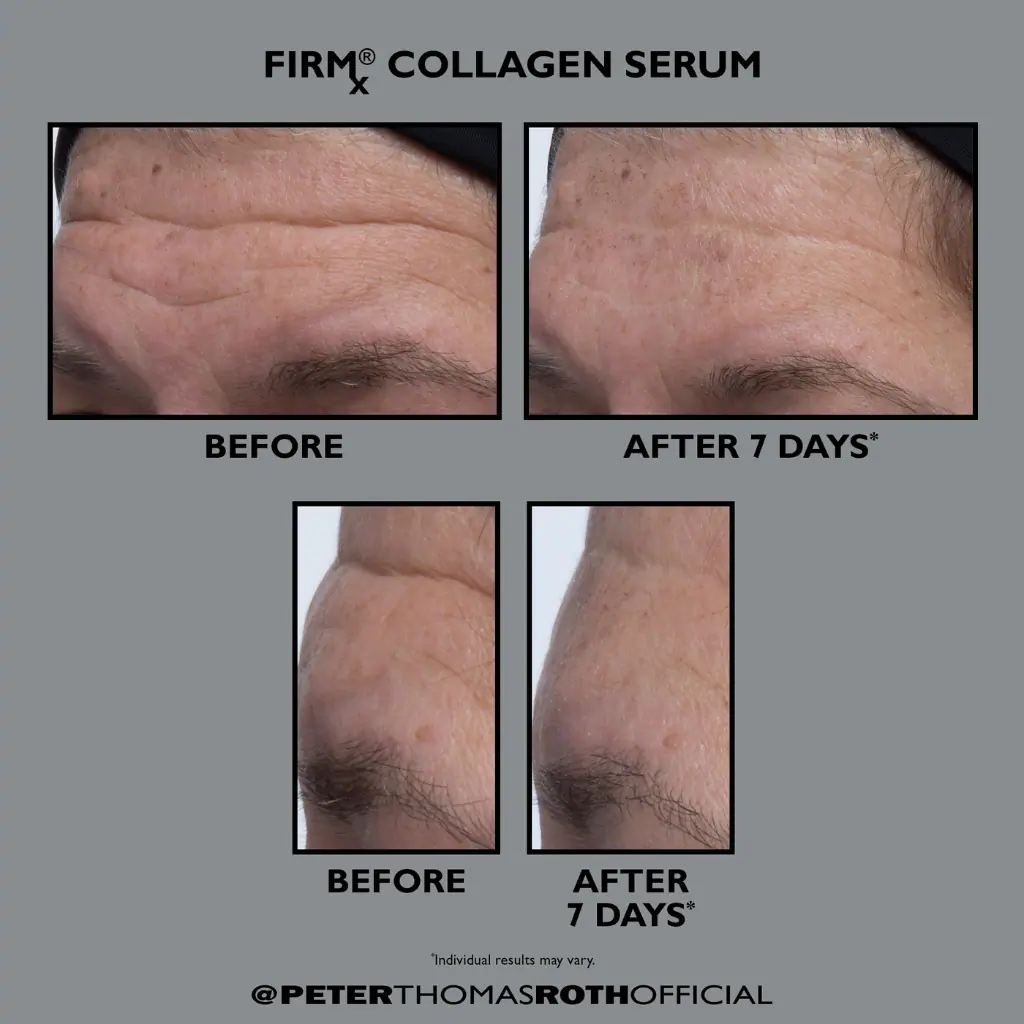 Peter Thomas Roth FirmX Collagen Serum 30ml