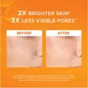 L'Oréal Paris Revitalift 12% Pure Vitamin C Face Serum 30ml