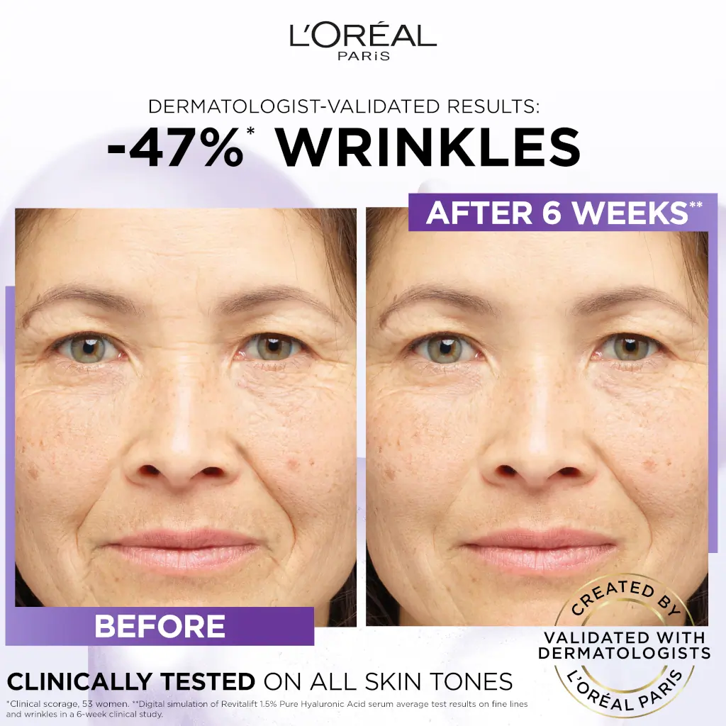 L'Oréal Paris Revitalift Filler 1.5% Pure Hyaluronic Acid Anti-Wrinkle Serum 30ml