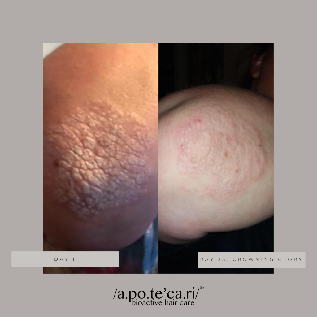 Apotecari Crowning Glory 90 Day Kit