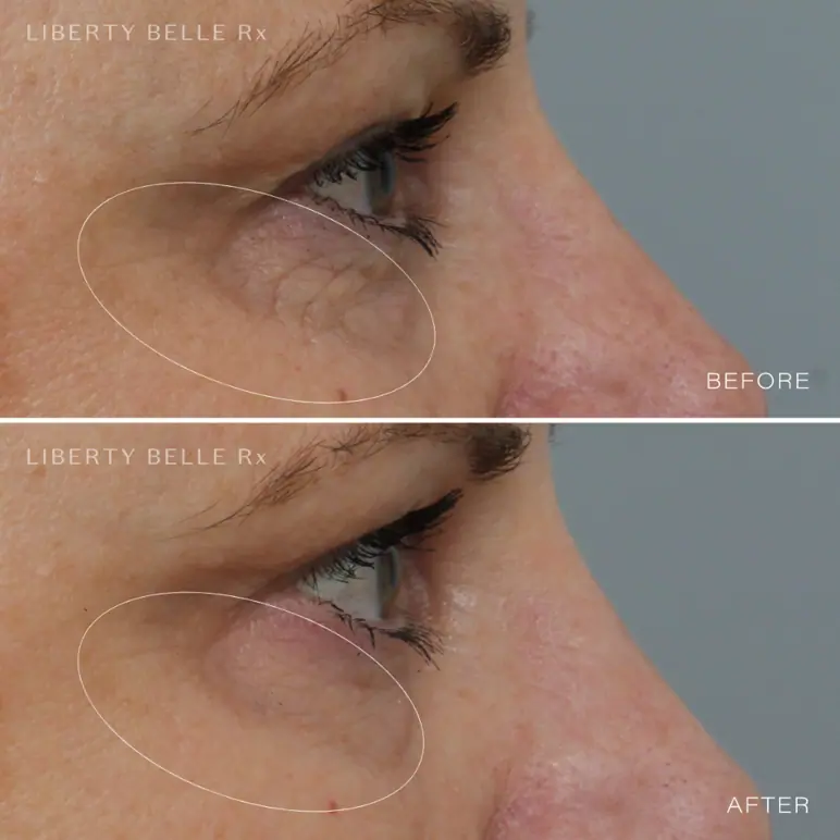 Liberty Belle Rx by Dr Moss EYE DO® Peptide Wrinkle Defence Eye Gel - 15ml