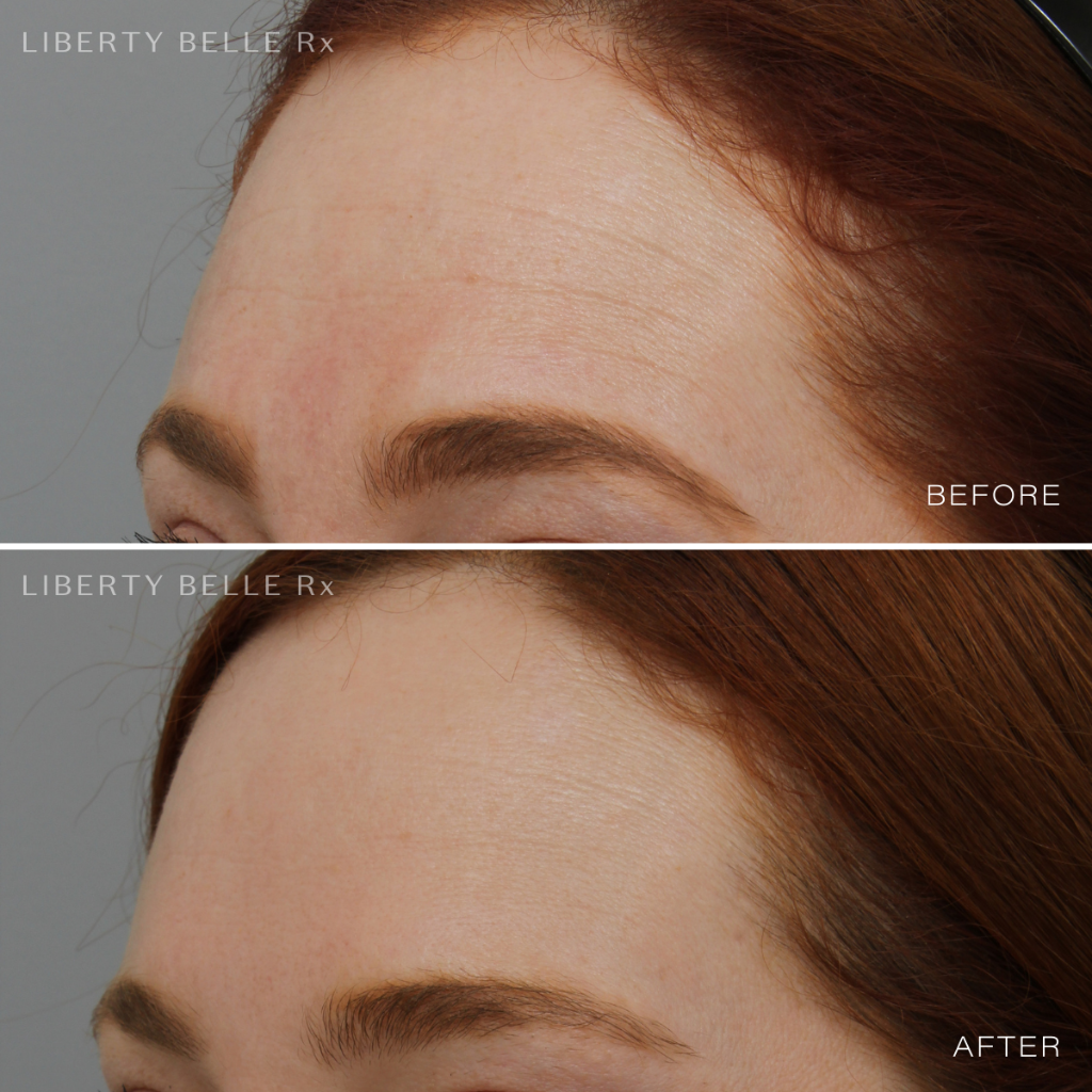 Liberty Belle Rx by Dr Moss GLAM SQUAD® Hyaluronic Acid Hydrating & Brightening Serum - 30ml