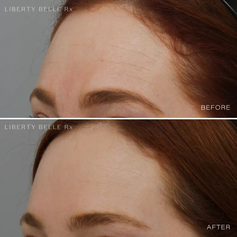 Liberty Belle Rx by Dr Moss GLAM SQUAD® Hyaluronic Acid Hydrating & Brightening Serum - 30ml