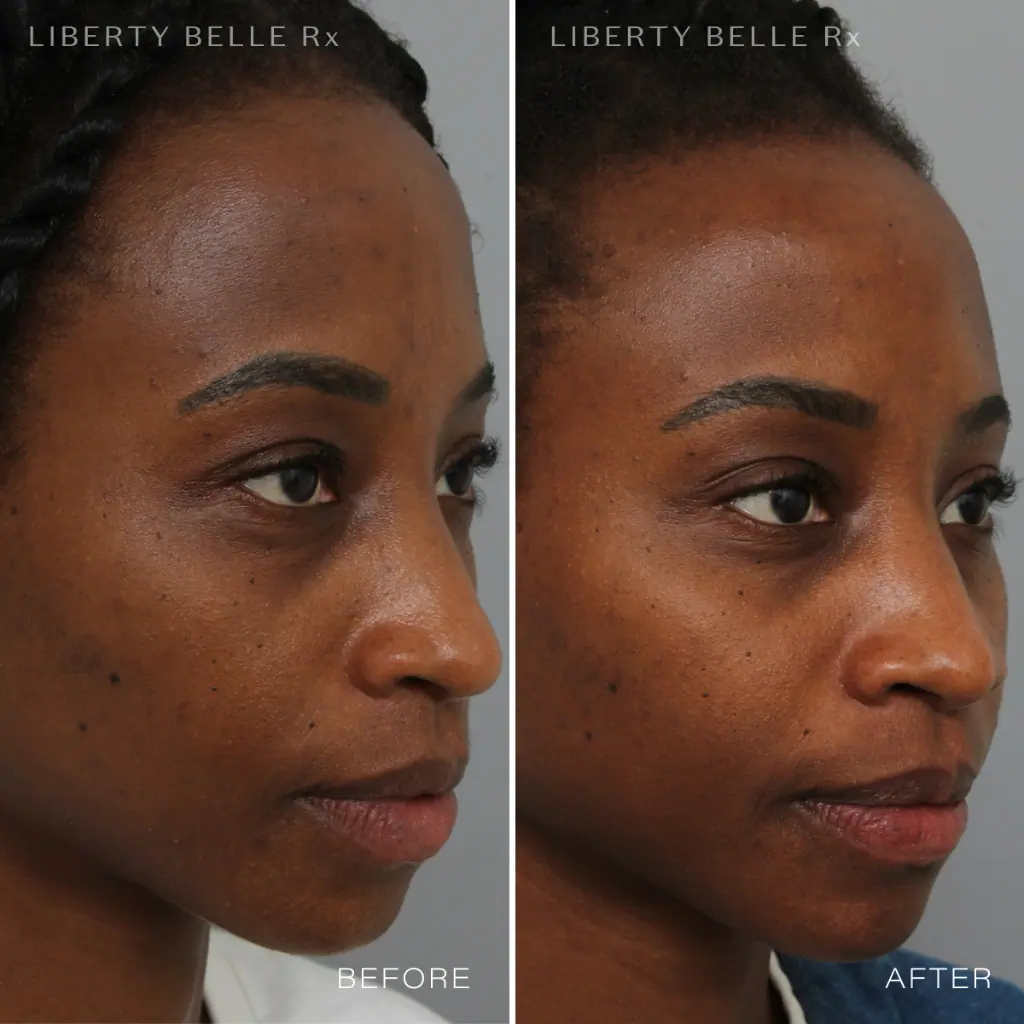 Liberty Belle Rx by Dr Moss SUPERHERO® Antioxidant Wrinkle Defence Cream with Vitamin C - 50ml