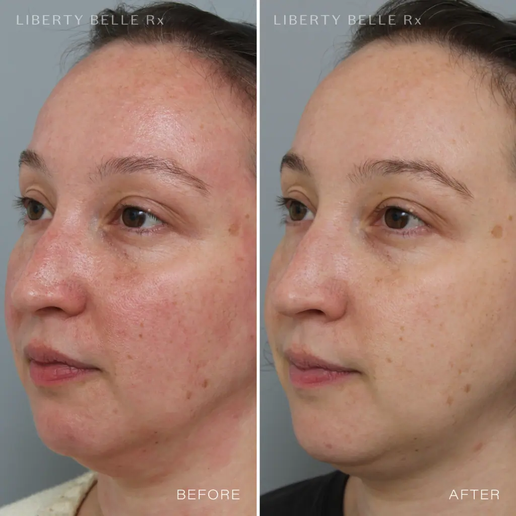 Liberty Belle Rx by Dr Moss POWER BROKER® Anti-Red Wrinkle Defence Cream with Squalane - 50ml