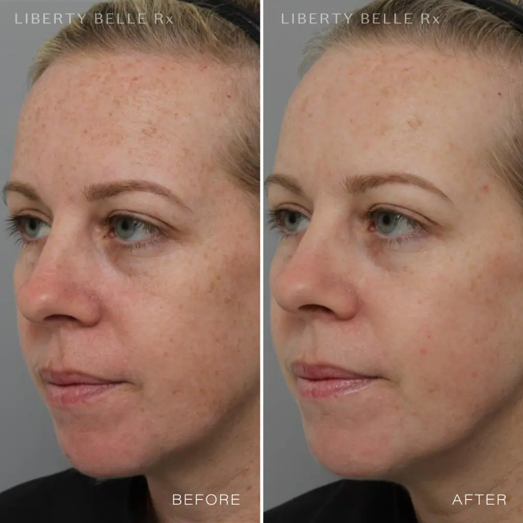 Liberty Belle Rx by Dr Moss DATE NIGHT® Leave-On Hydration & Anti-Ageing Mask with Ceramides - 50ml