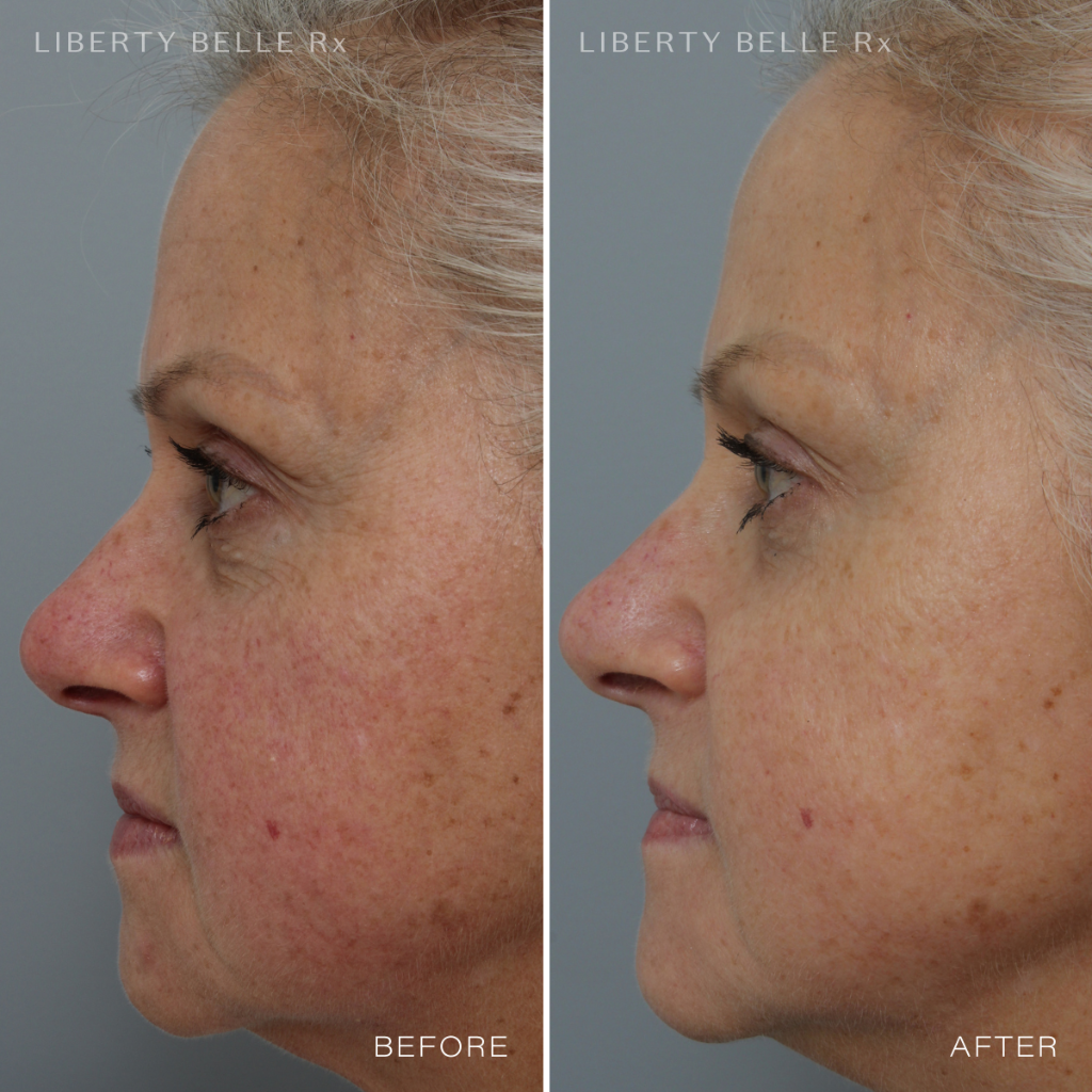 Liberty Belle Rx by Dr Moss STAR QUALITY® Rich Super Anti-Ageing Cream with Bakuchiol - 50ml
