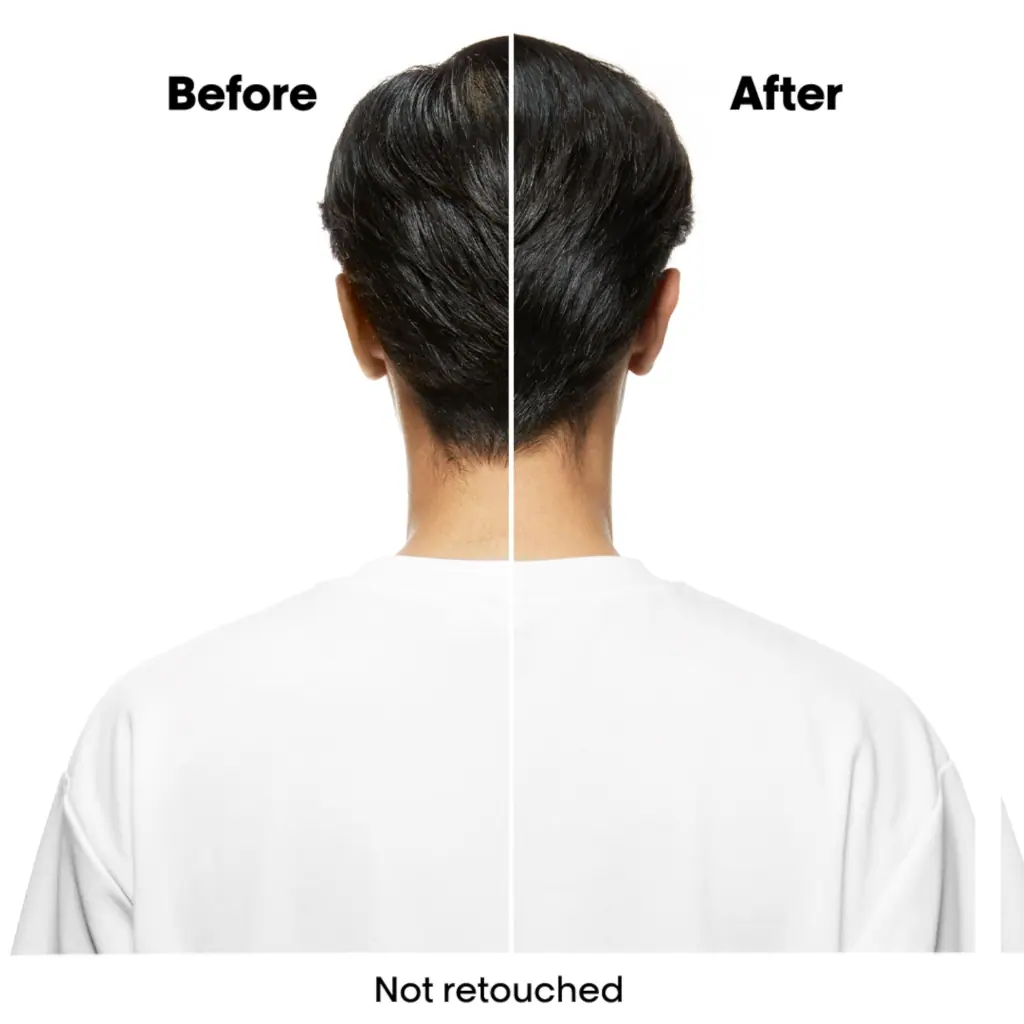 L'Oréal Professionnel Scalp Advanced Anti-Oiliness Mask