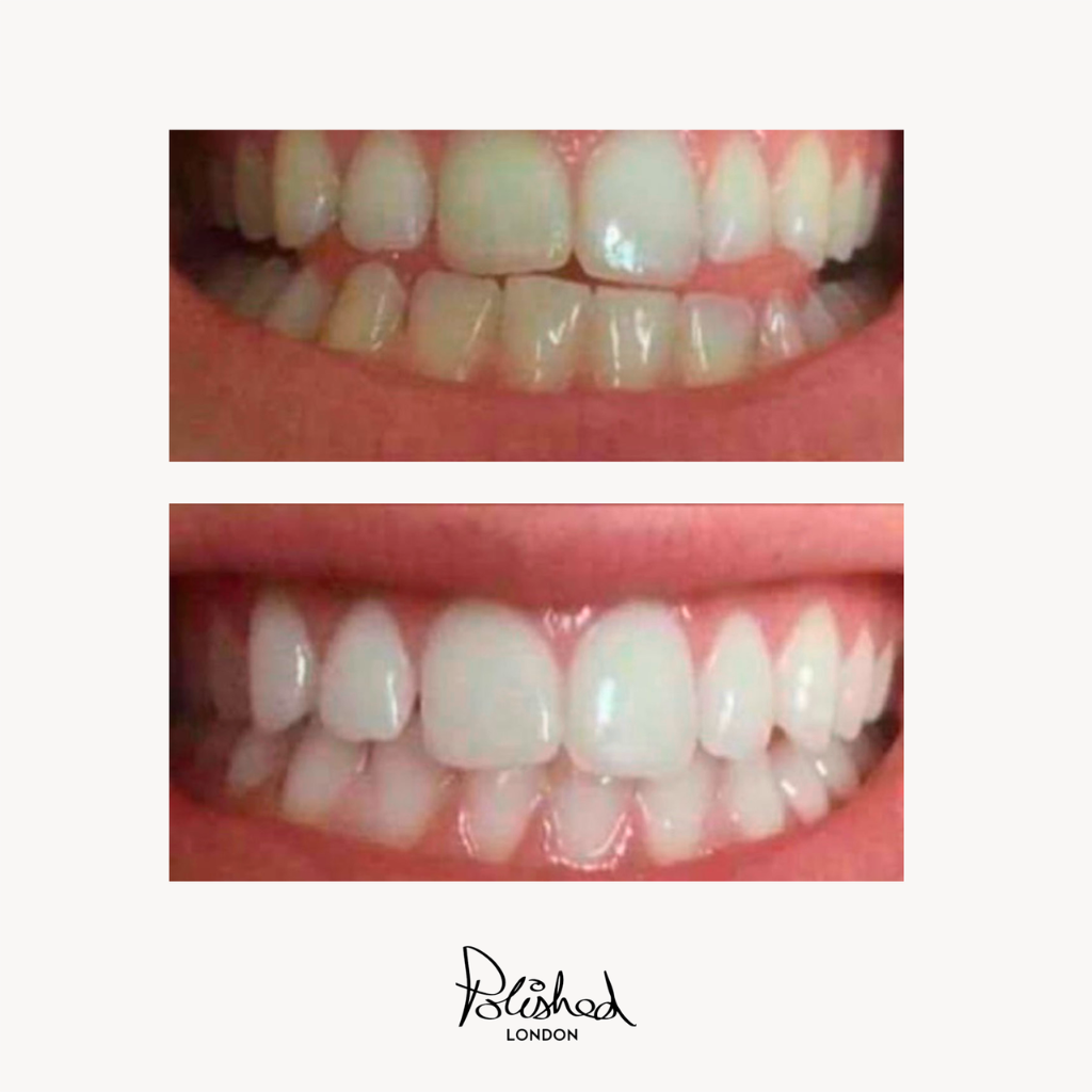Polished London Teeth Whitening Powder