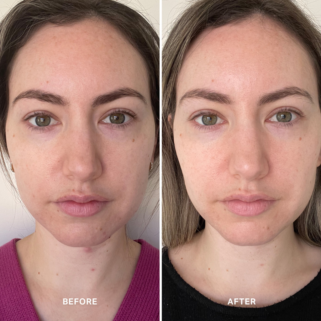 Alpha-H Vitamin B Serum with 5% Niacinamide 25ml