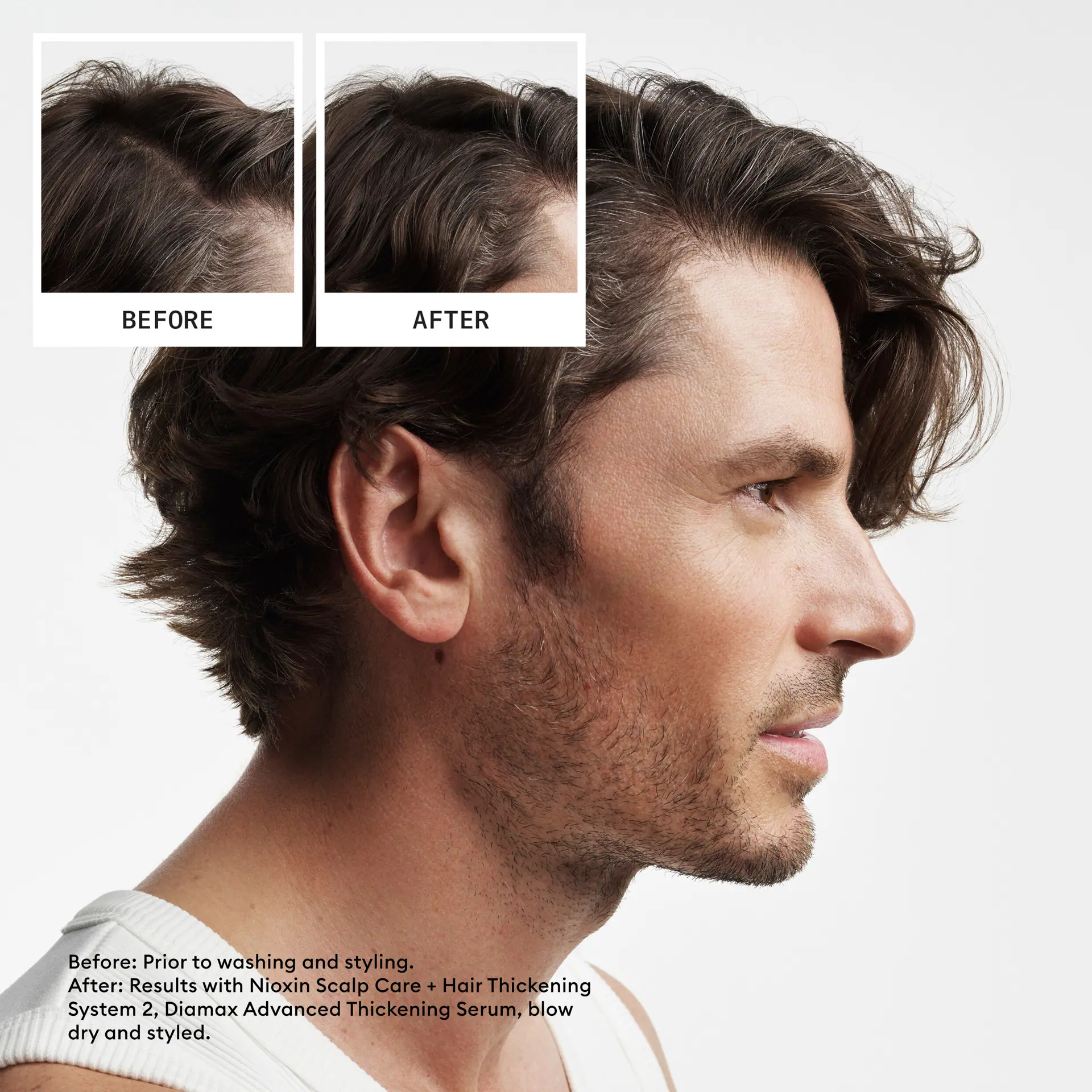 Nioxin Scalp + Hair Thickening System 2 - Hair Thickening System Trial Kit