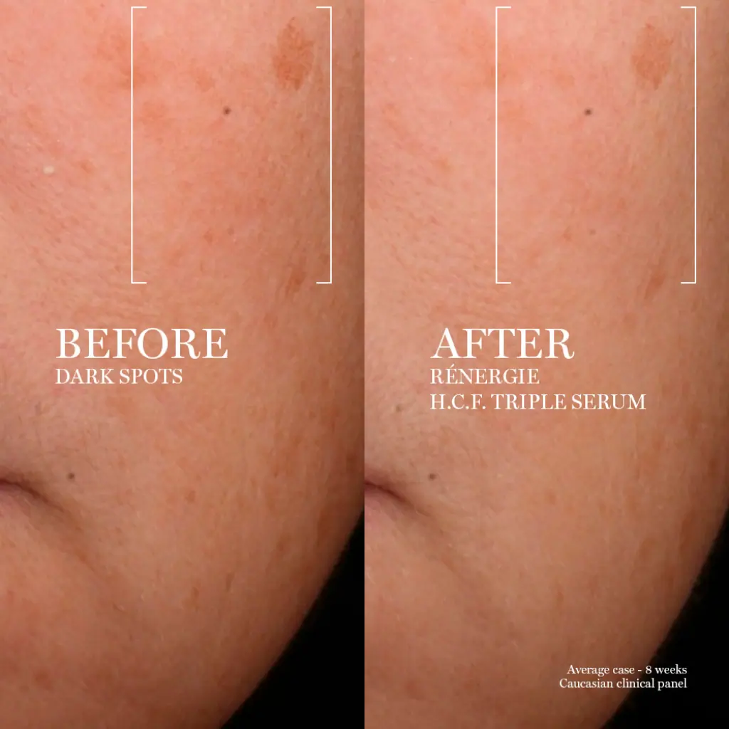 Lancôme Rénergie Triple Serum 20ml