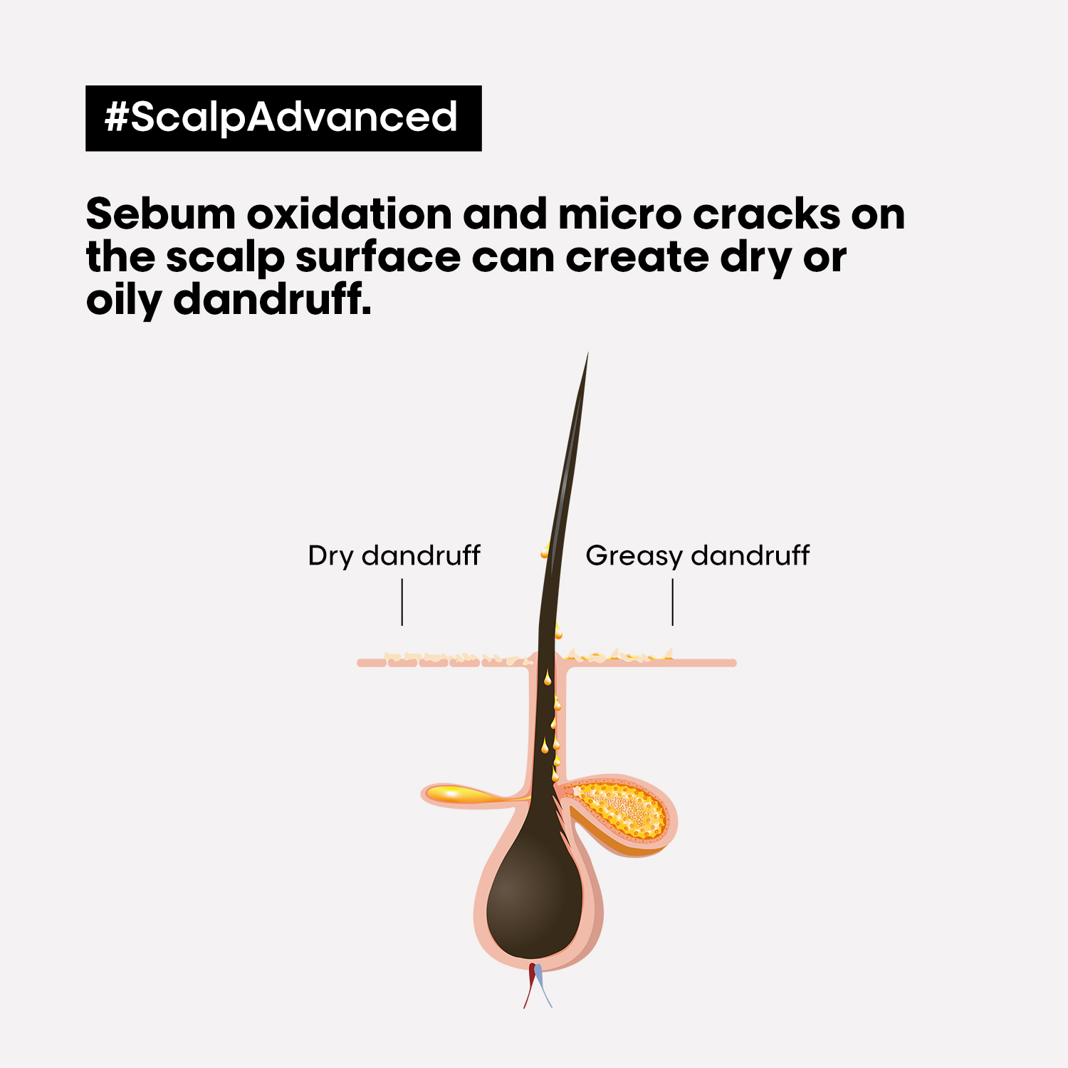 L'Oréal Professionnel Serie Expert Scalp Advanced Anti-Dandruff Shampoo 300ml