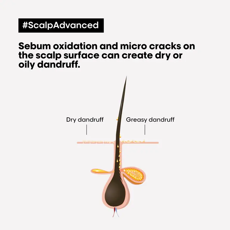 L'Oréal Professionnel Serie Expert Scalp Advanced Anti-Dandruff Shampoo 300ml