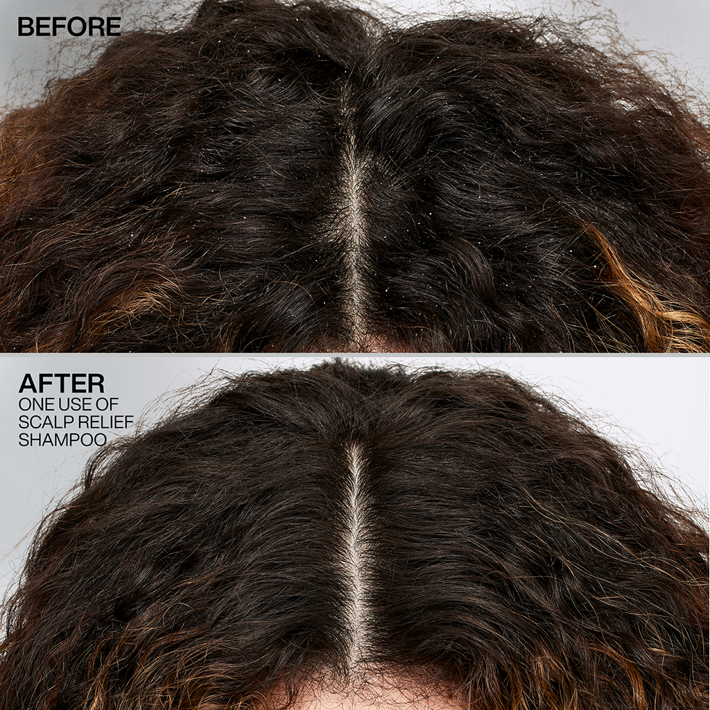 Redken Dandruff Control Shampoo
