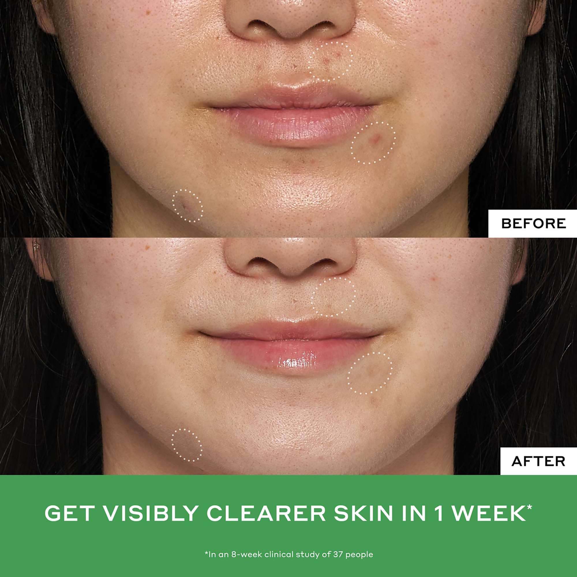 Ole Henriksen Balance + Detox Drops 2% Salicylic Acid Toner