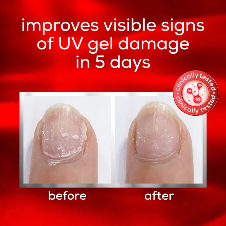 Essie To The Rescue Advanced Nail Treatment
