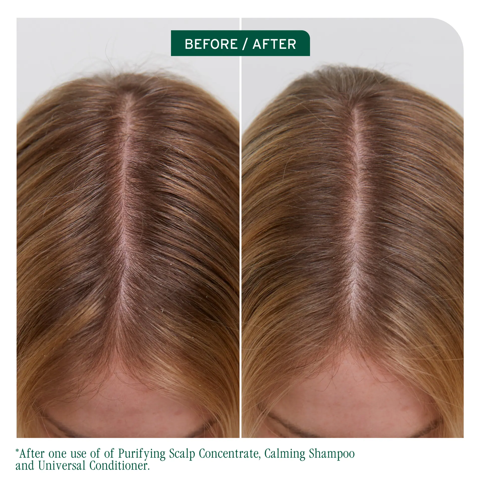 Biolage Scalp Sync Universal Conditioner 236ml