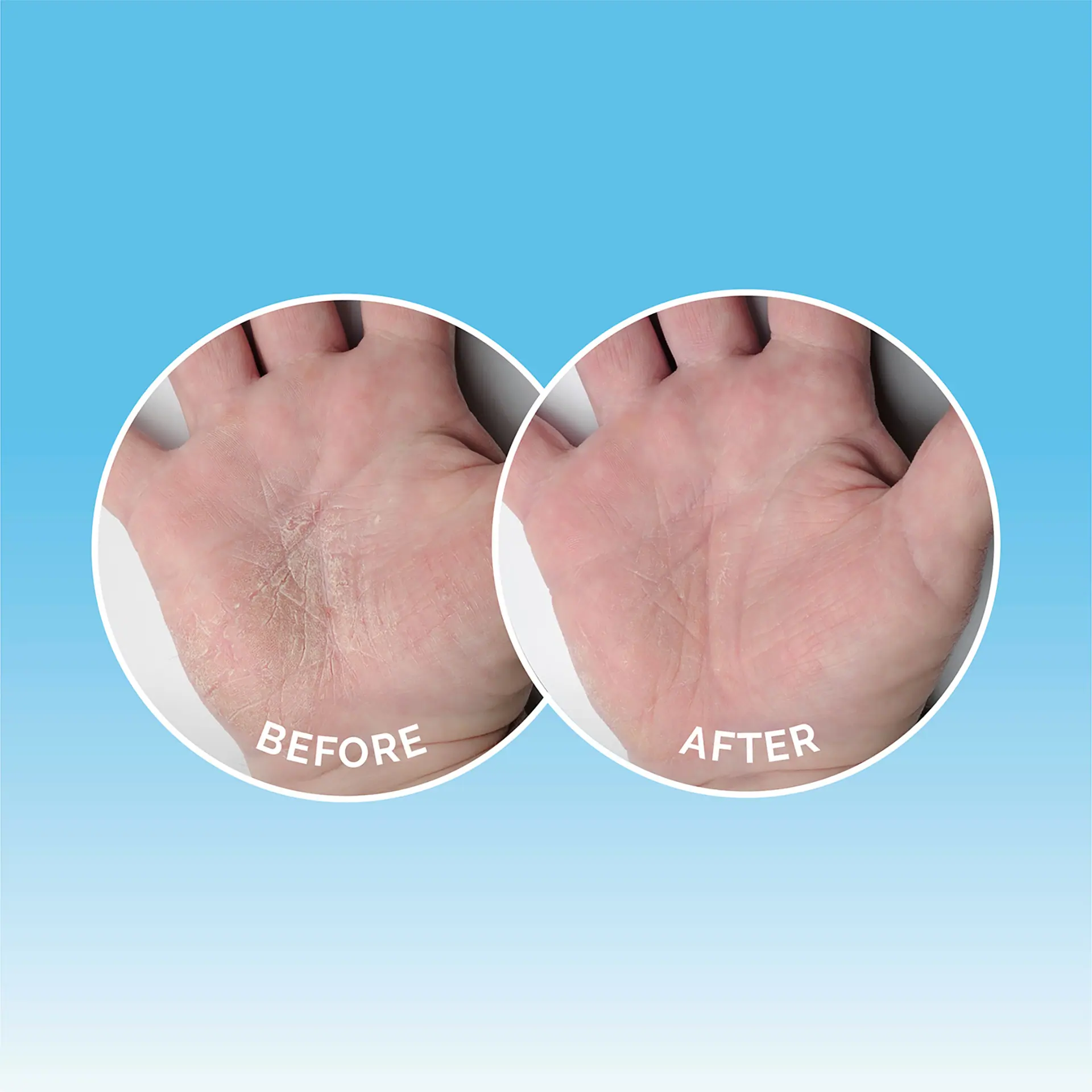 Dermal Therapy Hand Balm