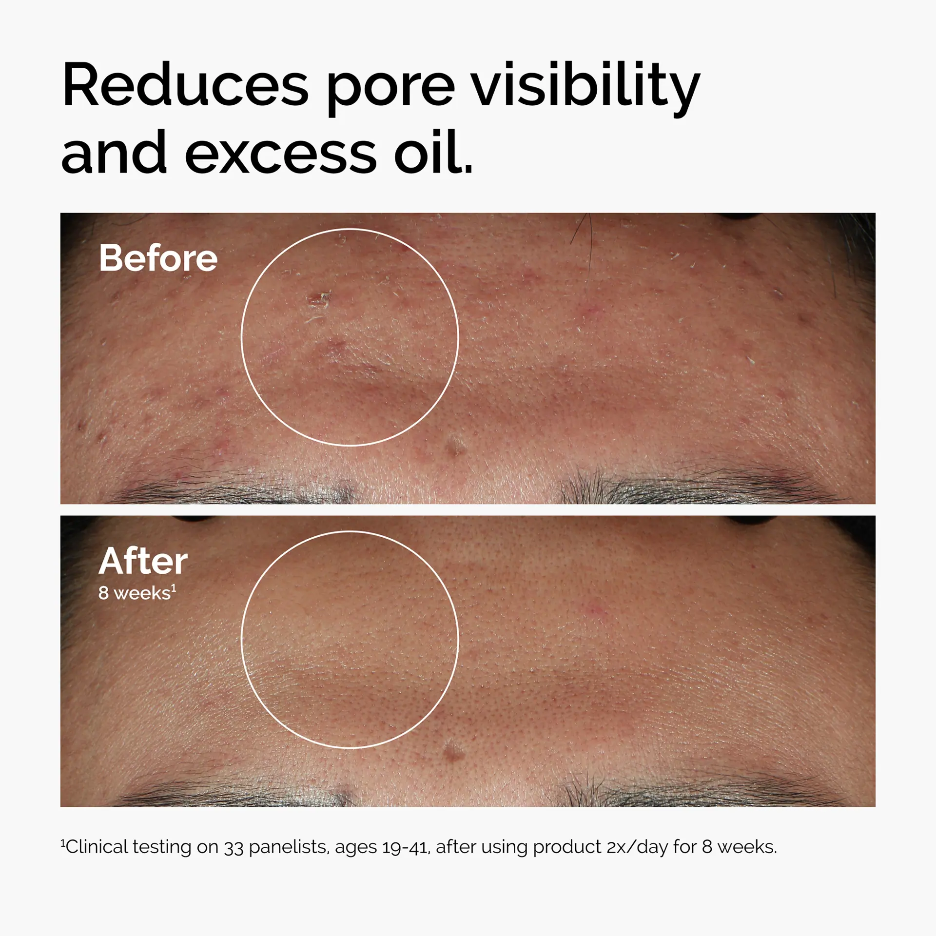The Ordinary Supersize Niacinamide 10% + Zinc 1% - 60ml