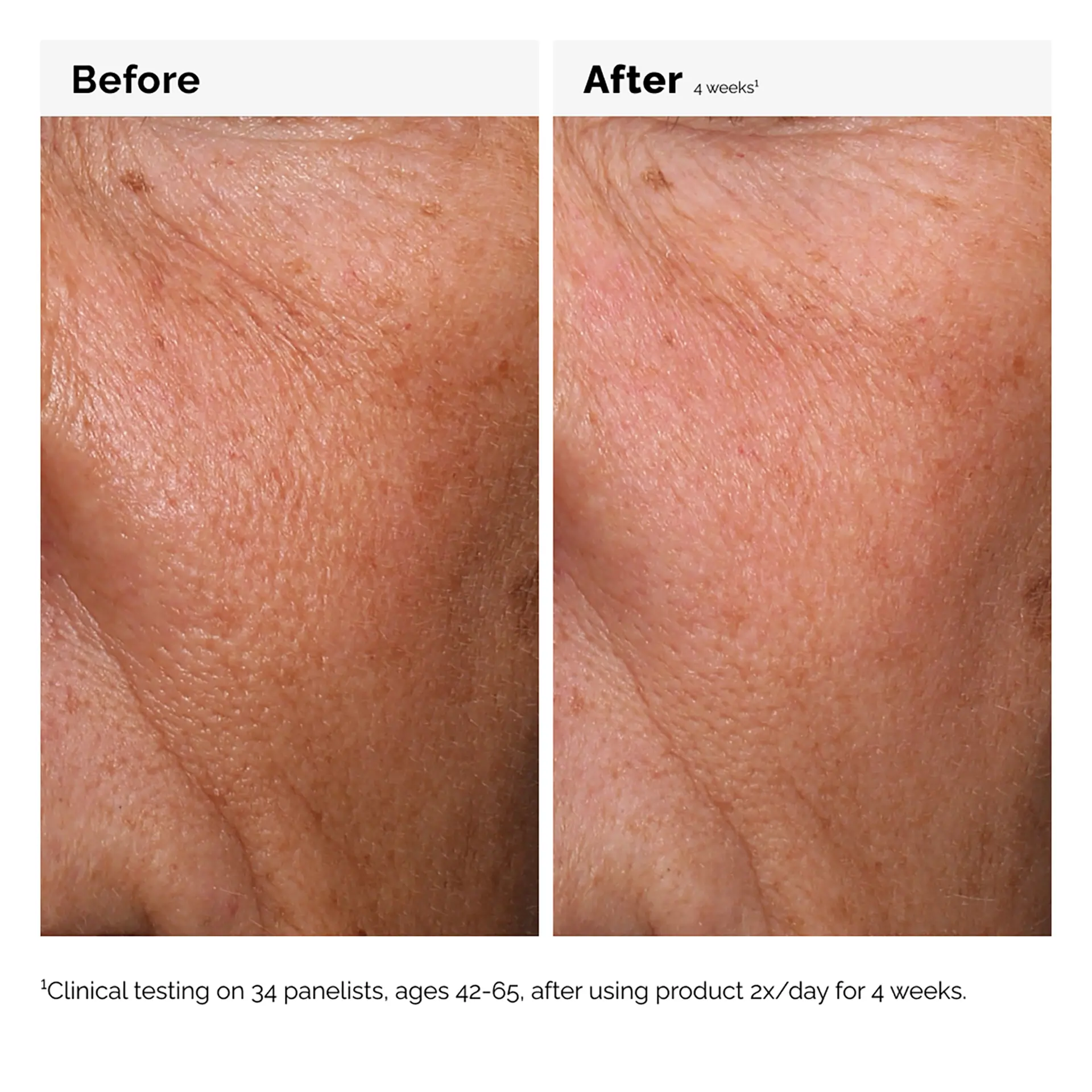The Ordinary Hyaluronic Acid 2% + B5 - 30ml