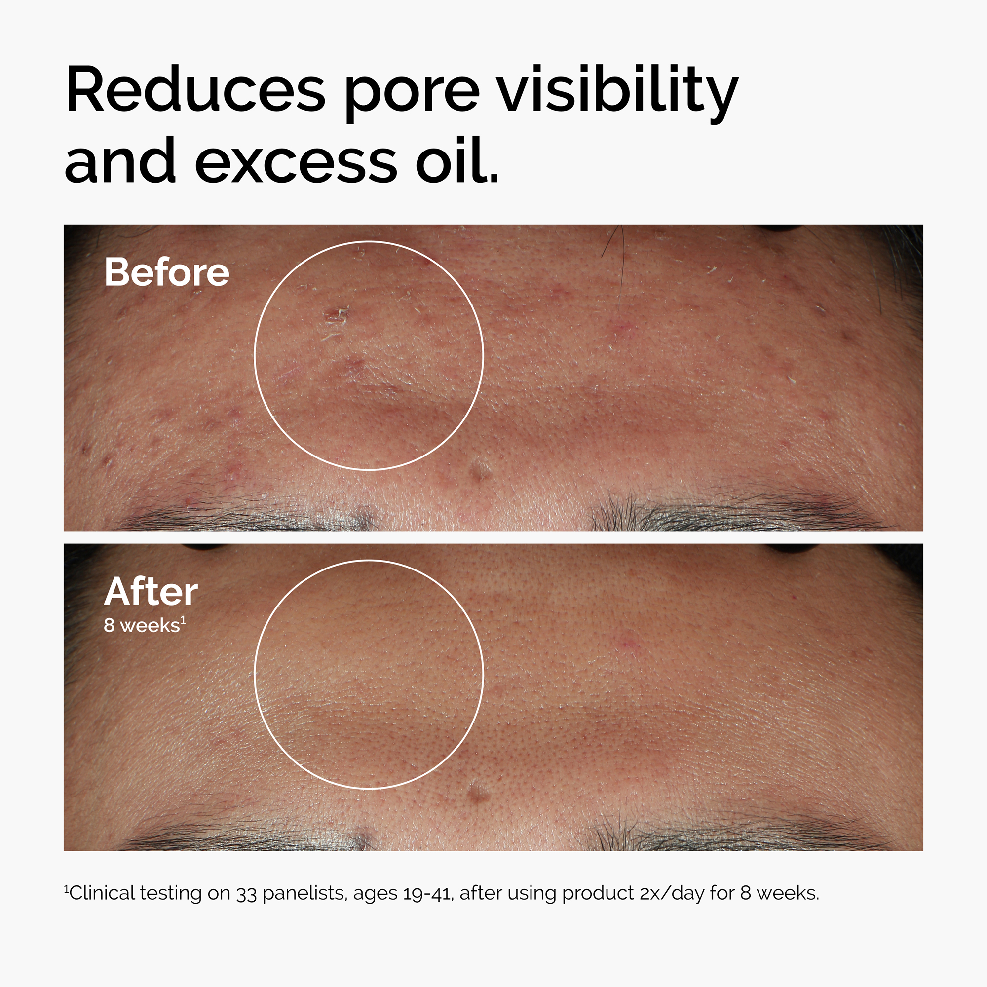 The Ordinary Niacinamide 10% + Zinc 1% - 30ml