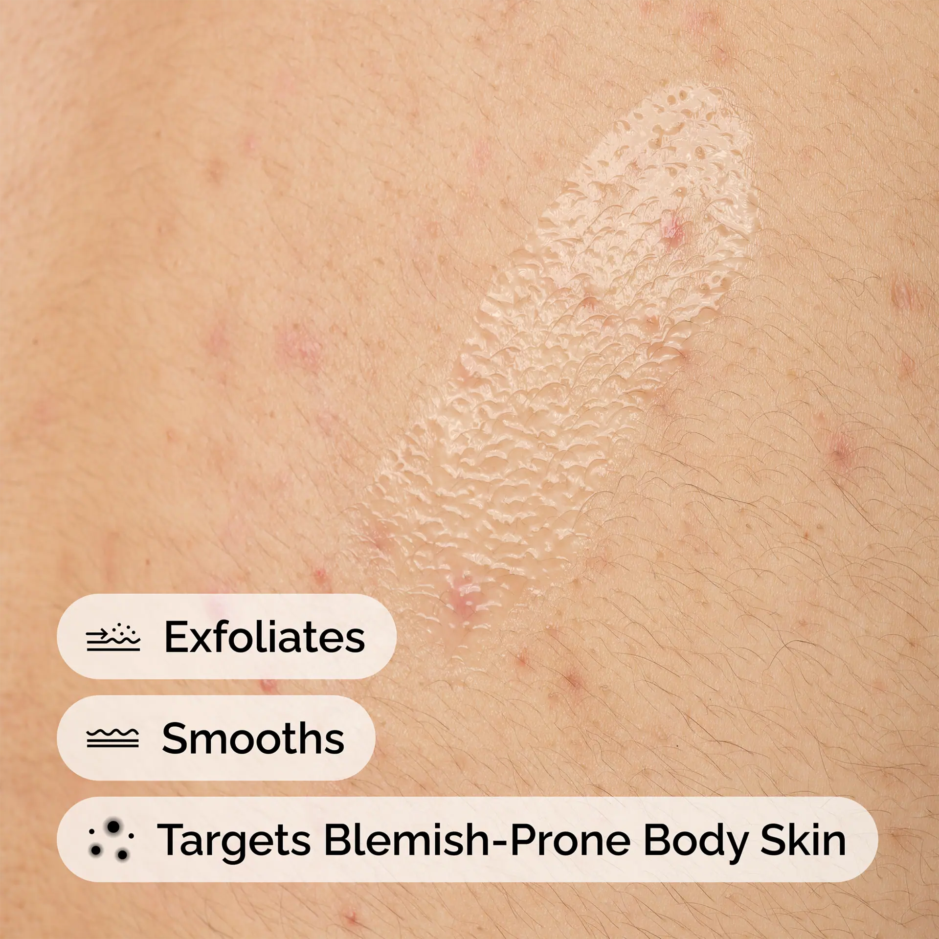 The Ordinary Salicylic Acid 0.5% Body Serum - 240mL