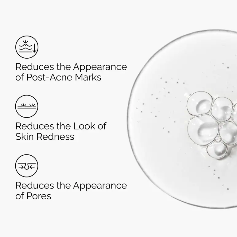 The Ordinary Aloe 2% + NAG 2% - 30ml