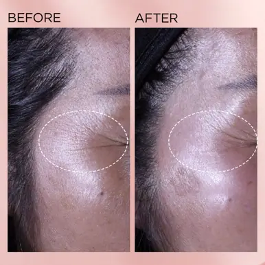 Elizabeth Arden Retinol + HPR Ceramide Capsules 60pcs