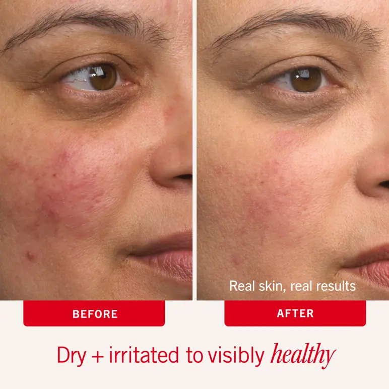 First Aid Beauty Ultra Repair Cream 59ml