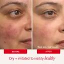 First Aid Beauty Ultra Repair Cream 237ml