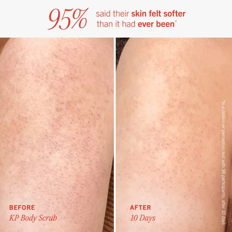 First Aid Beauty Soft + Smooth Starter Kit