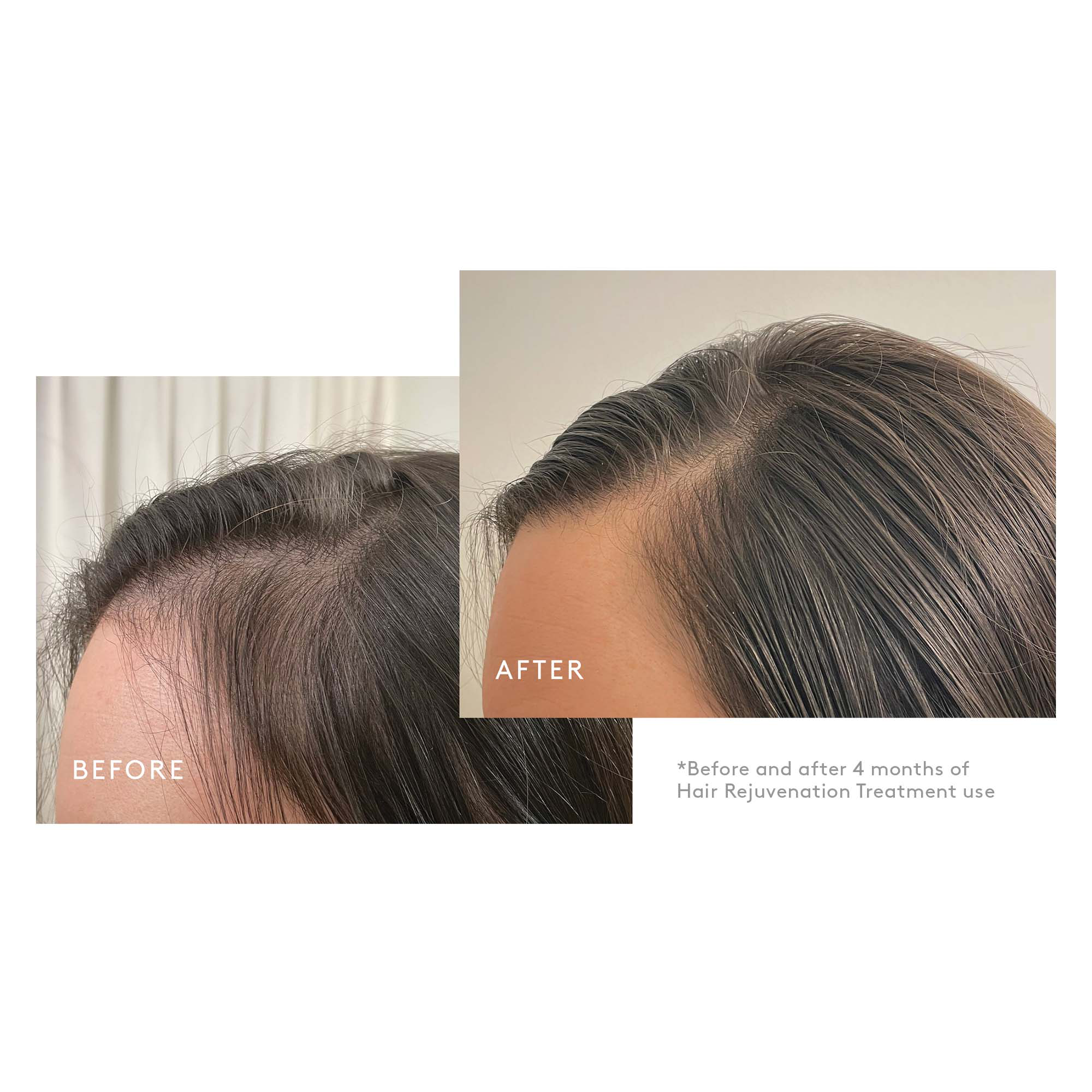 VIRTUE Flourish Hair Rejuvenation Treatment 1 Month