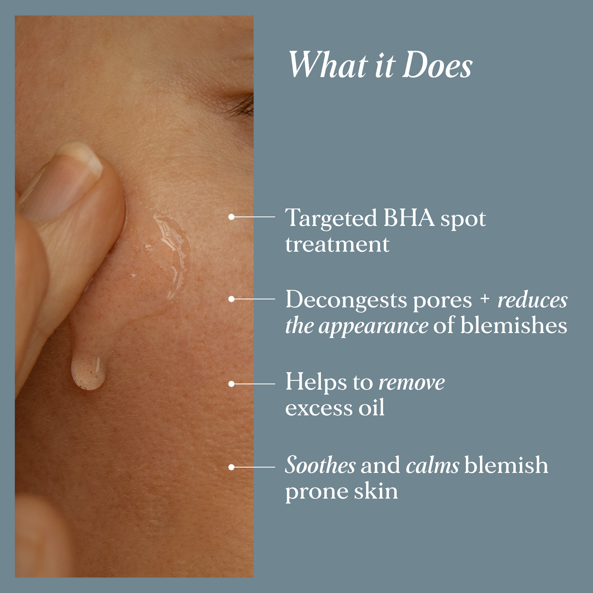 Alpha-H INSTANT ACTION BHA BLEMISH TREATMENT with 2% Salicylic Acid 20ml
