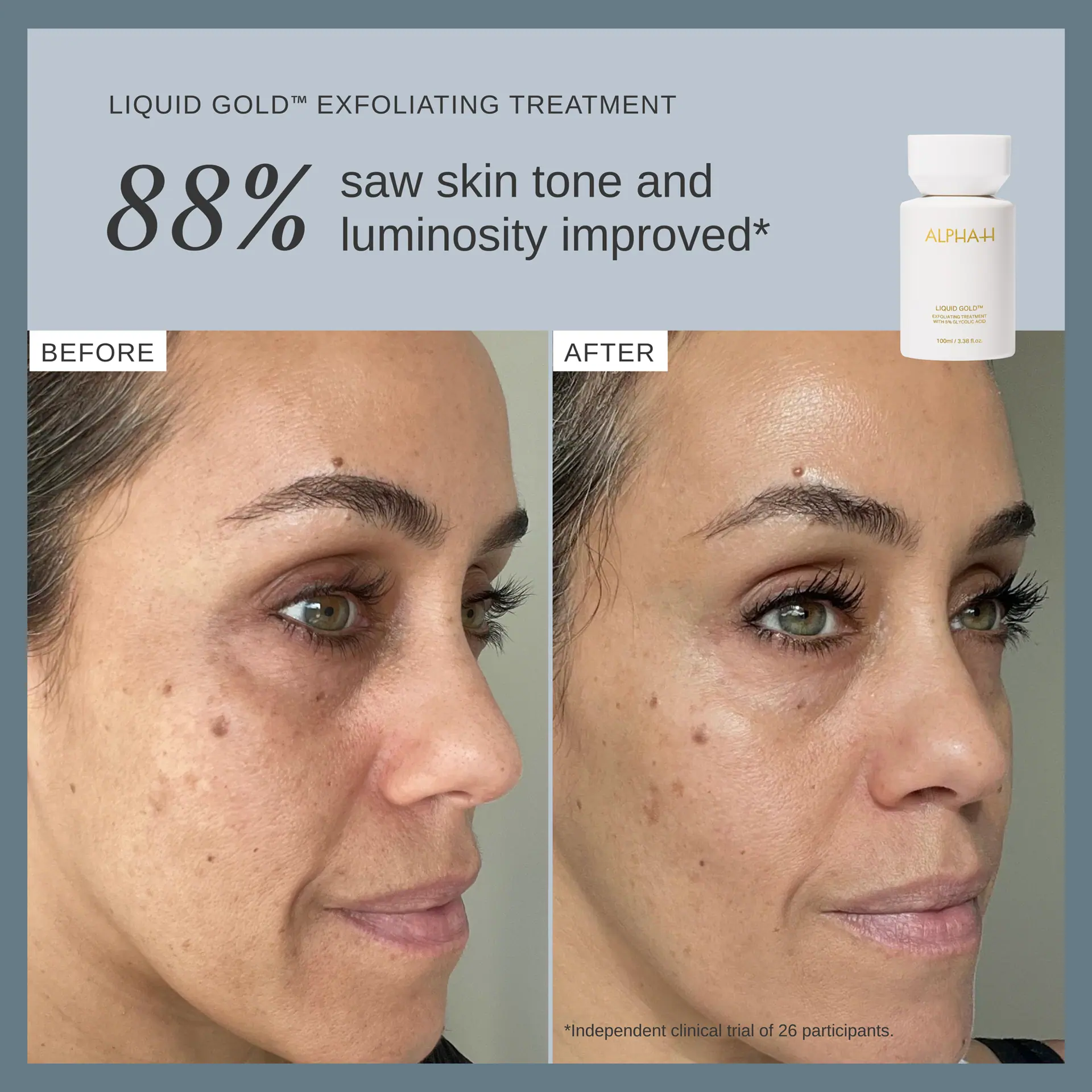 Alpha-H Liquid Gold Exfoliating Treatment 100ml