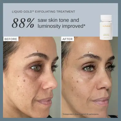 Alpha-H Liquid Gold Exfoliating Treatment 100ml