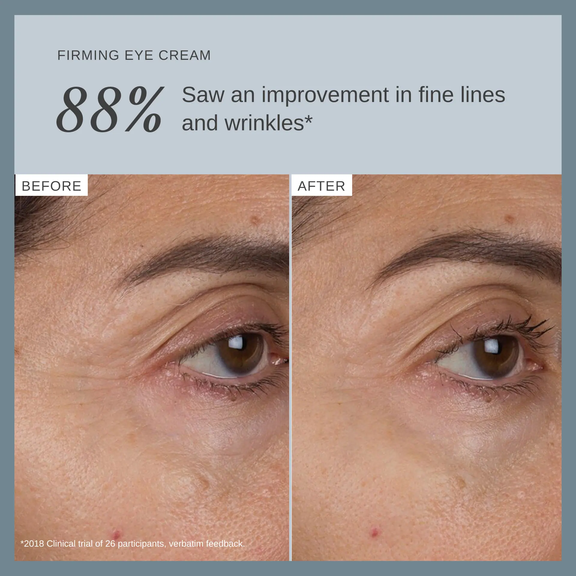 Alpha-H Liquid Gold Firming Eye Cream