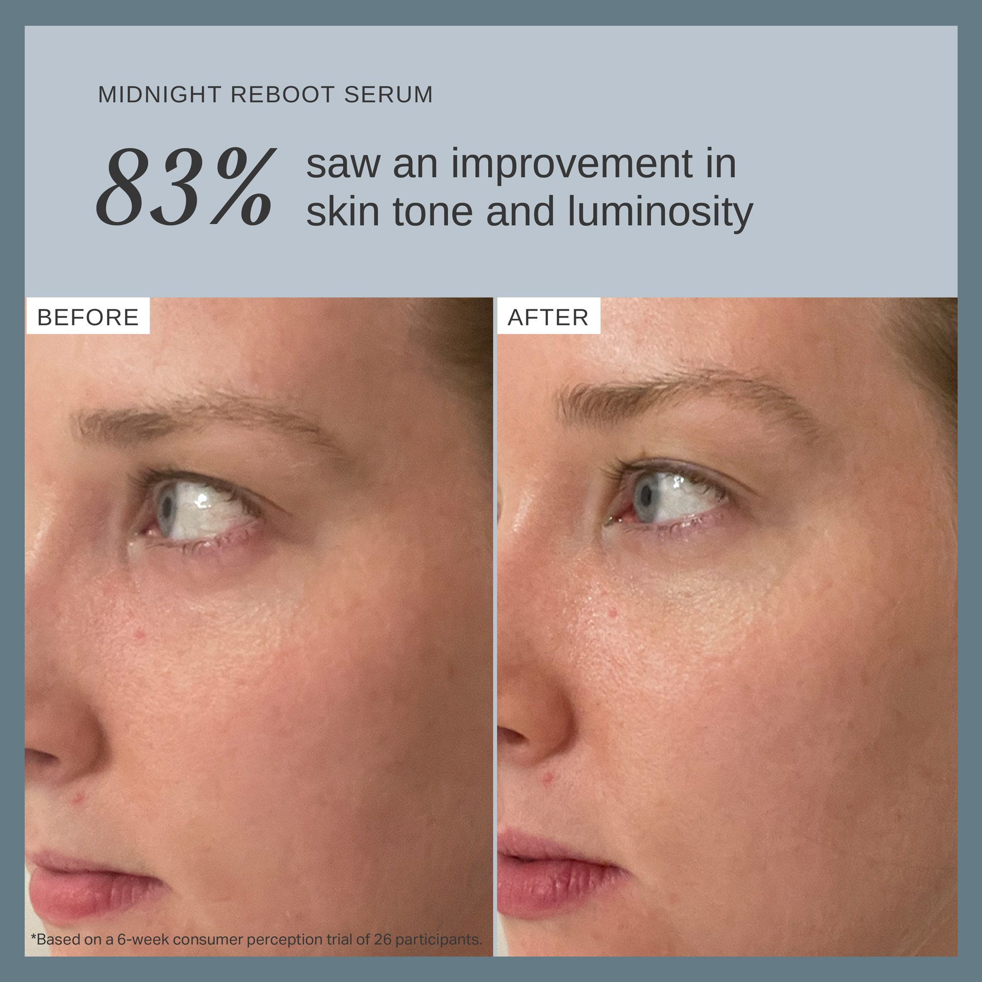Alpha-H Midnight Reboot Serum with 14% Glycolic Acid + 1% Retinoid Complex 50ml