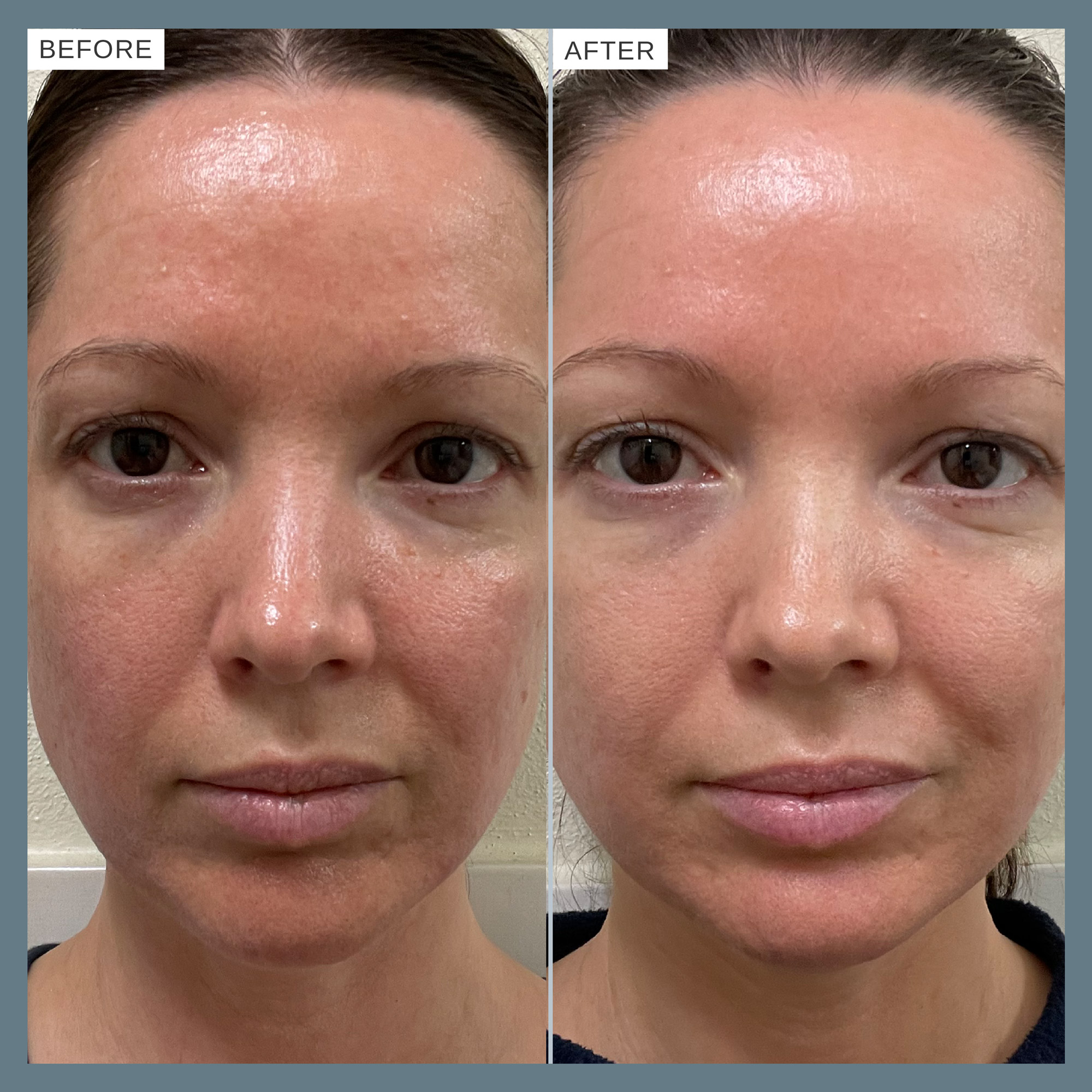 Alpha-H Vitamin B Serum with 5% Niacinamide 25ml