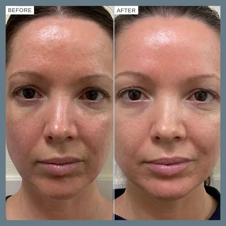 Alpha-H Vitamin B Serum with 5% Niacinamide 25ml
