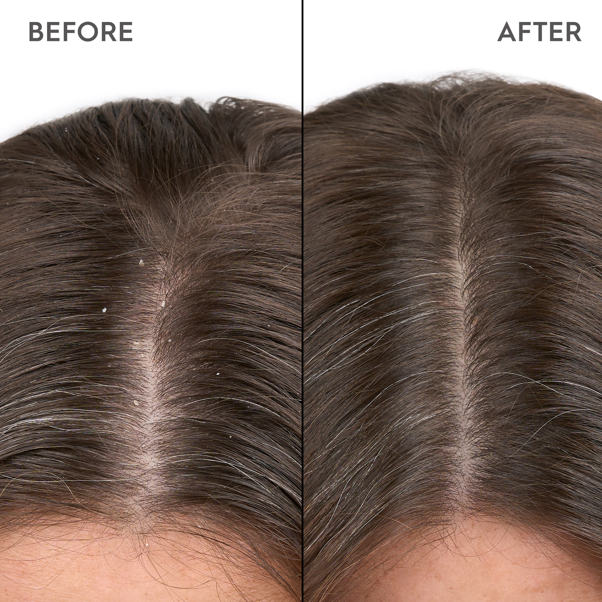 KERASILK Anti-Dandruff Scalp Serum 100ml
