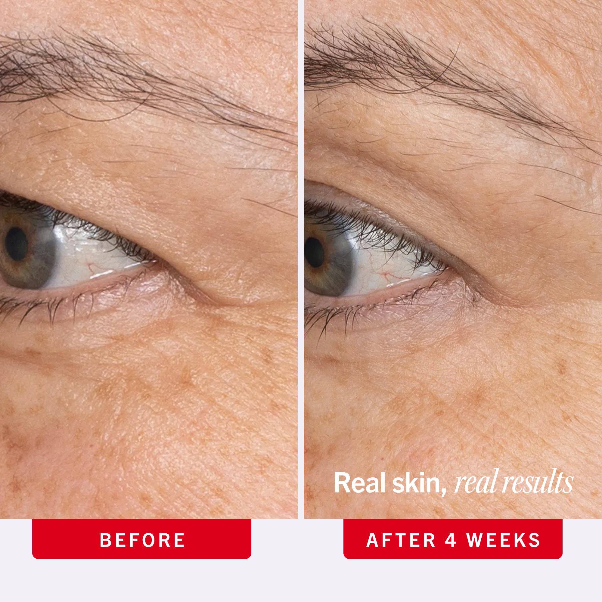 First Aid Beauty Ultra Repair Retinol Eye Cream 15ml